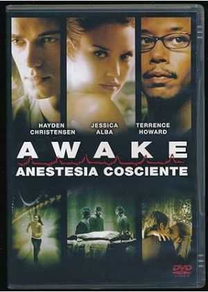 AWAKE - ANESTESIA COSCIENTE - DVD